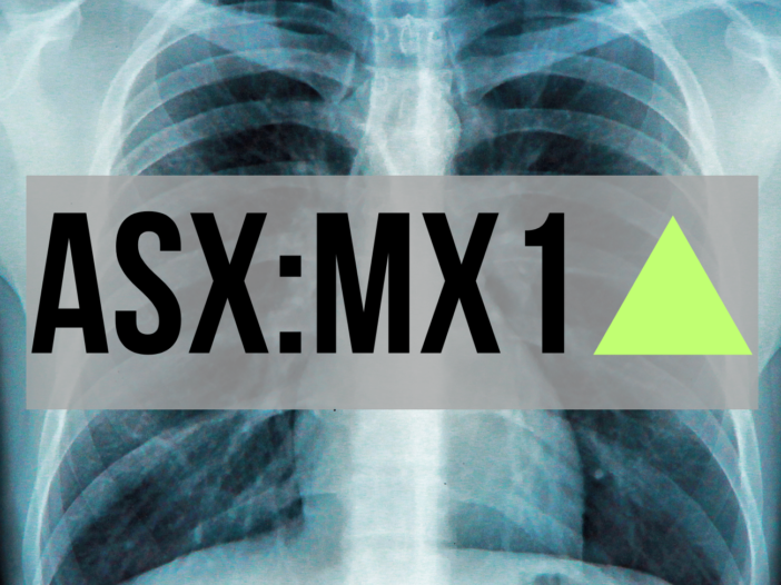 ASX:MX1 micro x